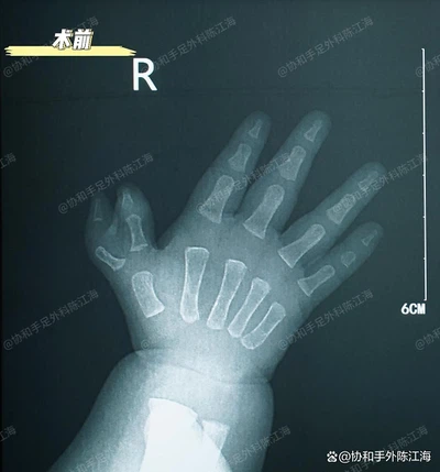 info-1038-1114 info-1038-1114